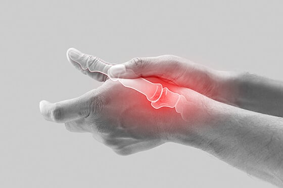 Close up showing a hand injury.